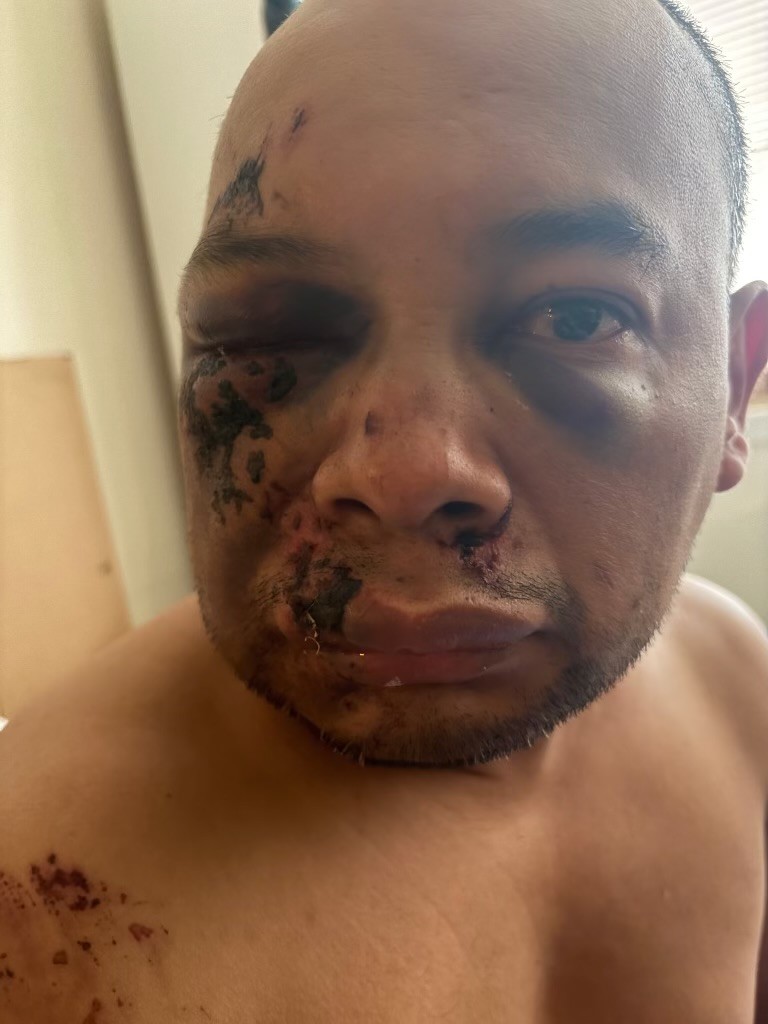 BREAKING: Arlington Police Open Investigation Into ICE Encounter That Left Arlington Man With Brain Injury - Falls Church News-Press Online